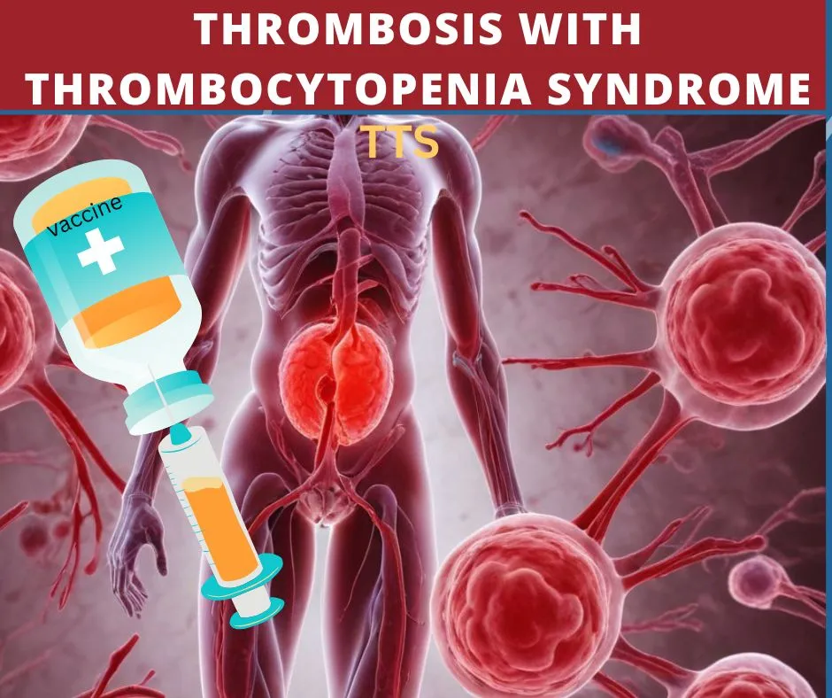 Thrombosis-with-Thrombocytopenia-Syndrome