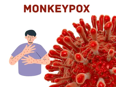 Monkeypox-India